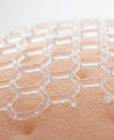 The use of MATRIDERMⓇ as a single stage salvage procedure to cover exposed dura Mater